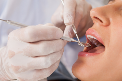 アフターフォロー